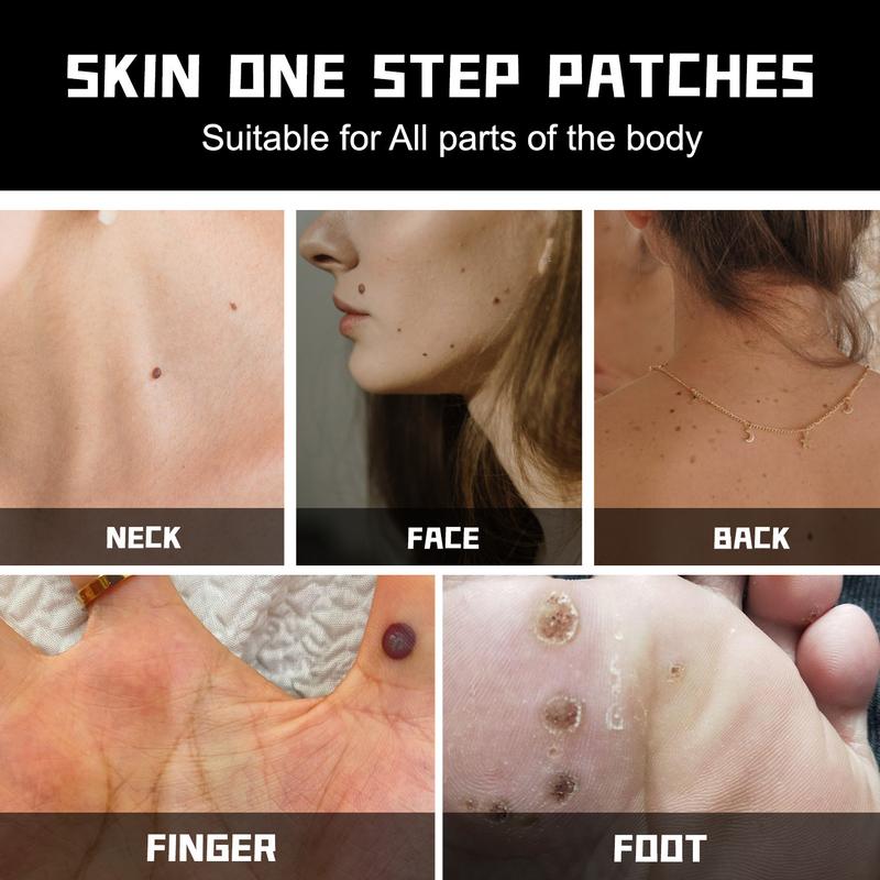 288 PCs Skin Care Patch Suit: Mild and Non-Irritating Wart Mole Acne Concealer Patch-Effective for Face and Foot, Suitable for All Skin Types