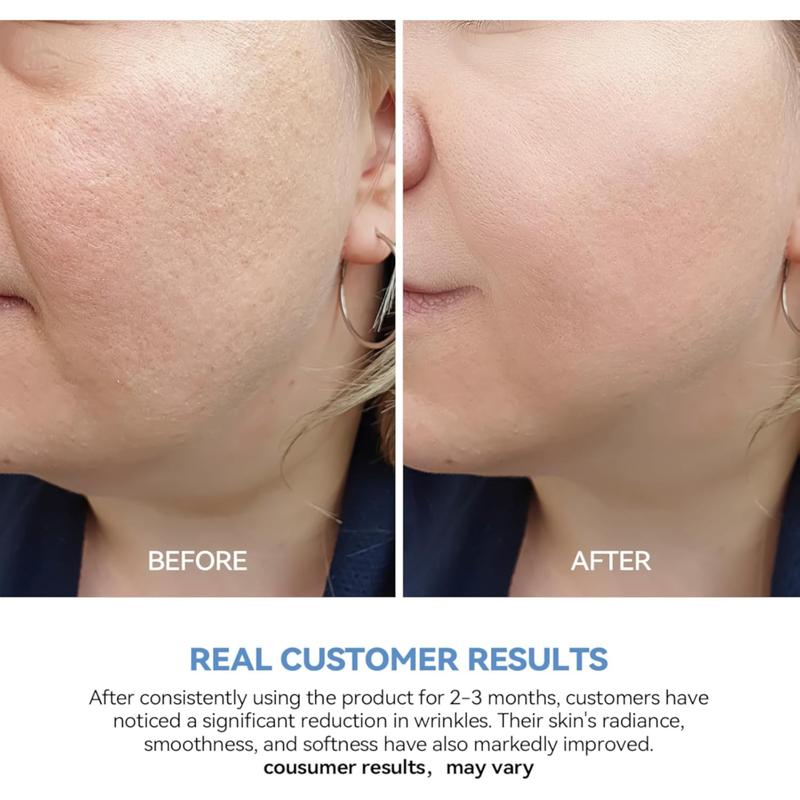 WNP 3% Hyaluronic Acid Serum Ultra-Hydrating Vials, Hyaluronic Acid Tubes, Ultra Hyaluronic Acid Tubes 30pcs Box, Glass Skin Ultra-Hydrating Serum